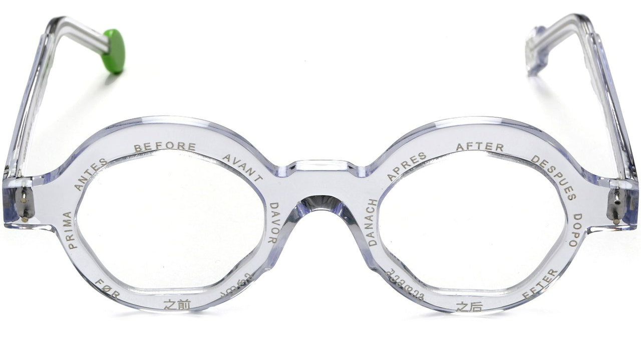 Before x After BA 01